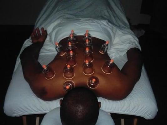 Cupping session