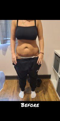 Before Lipo cavitation we started at a 36 in. waist.