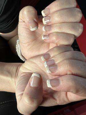 Acrylic nails that look absolutely disgusting after 4 days.