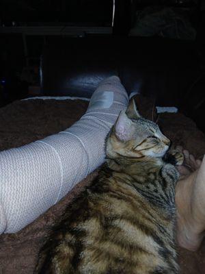 My left leg after I broke my pinky toe! Doc fixed me up!