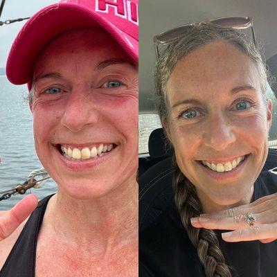 Before and after. No more discoloration from the last repair. Exceptional color match and shaping.