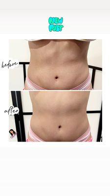 Glam Bodysculpting