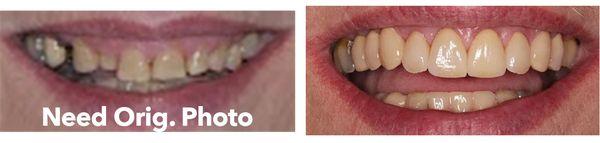 Dental Prosthodontics of Rochester