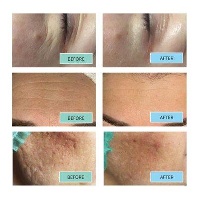 BioReTherapy by Bioskin Aesthetics