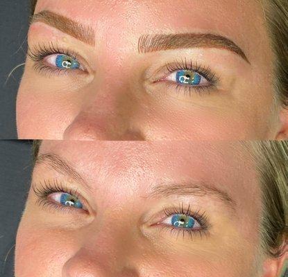 Top: After Bottom: Before