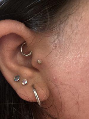 Infection? Earring going in my skin and purple around the piercing site.