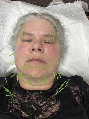 Nurturing Wellness Acupuncture