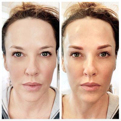 Before and after powdered brow