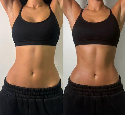 Targeted Area Sculpt