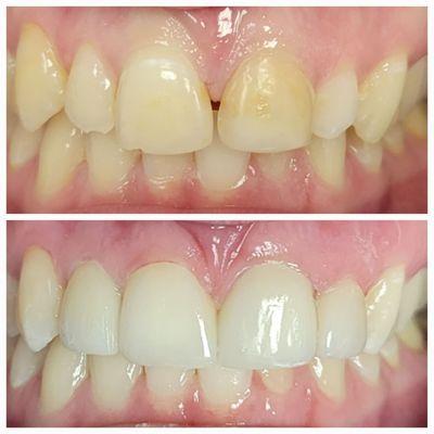 Samantha Wong, DMD - King of Prussia Family Dental Care