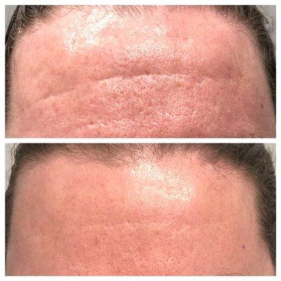 Trouvaille Med Spa Bourbonnais