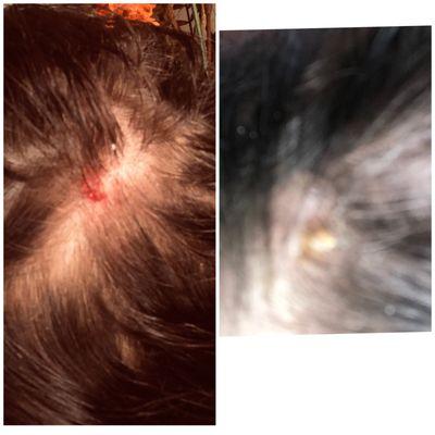 Lost lots of my hair unfortunately and got a infection on my head because of the place , be aware please
