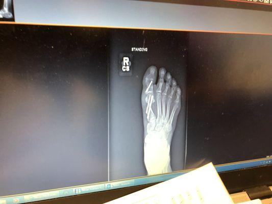 Resurgens Orthopaedics Spine Center