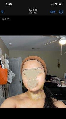 Inflammation going down (April 27)