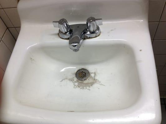 Disgusting bathrooms.