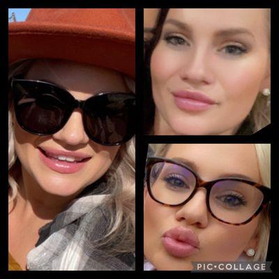 Lip filler and Botox