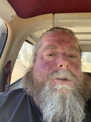 After first phone call with the older lady answering the telephone! I had had seven hart surgeries in past year and she was so mean i had a