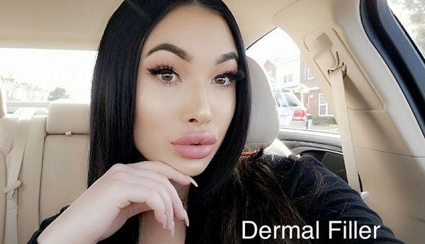 Lips by Michelle @ Tao Medical Spa