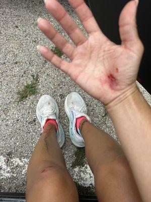 Boy Scout Hill - White Rock Lake