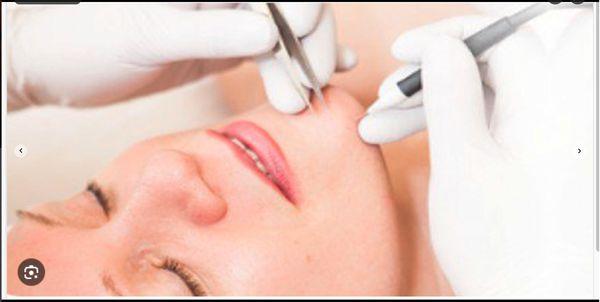 Flawless Electrolysis