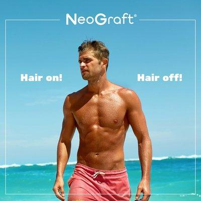 Neograft Hair Restoration Orange County
