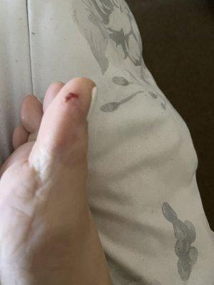 The cut on my toe from the pedicure