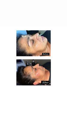 A Beautiful You Rejuvenation