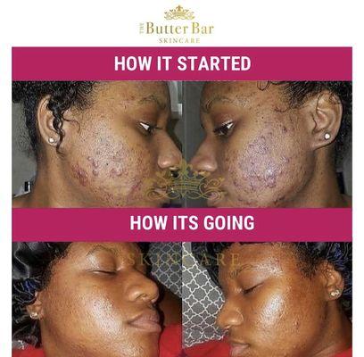 The Butter Bar Skincare