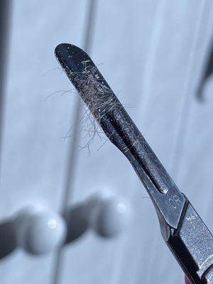 Dermaplaning is an amazing exfoliation technique which removes peach fuzz from the skin as well as dead skin cells!