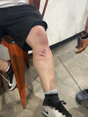 Golpe hecho por el equipo contrario