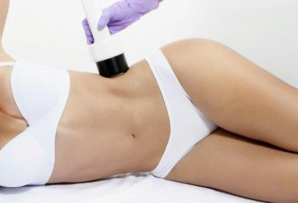 Ultra Cavitacion, lose inches in some areas.