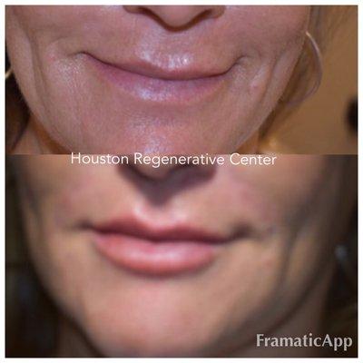 Houston Regenerative Center