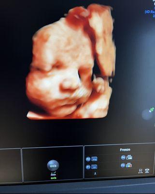 4D ultrasound at 27 weeks