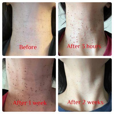 Linnell Dermatology and Aesthetics