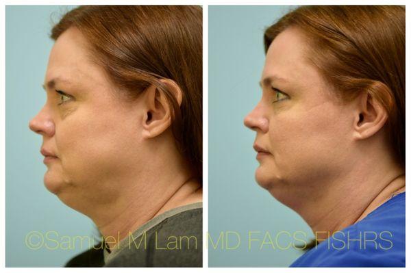 Lam Facial Plastics