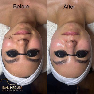 Idan Med Spa