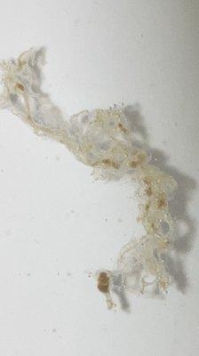 Who knows, but images were shown prior to surgery being performed so obviously the doctor doesn't care either