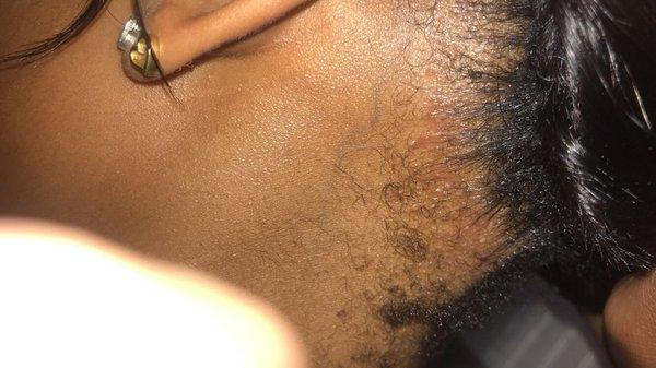 the bumps from the TIGHT braiding.
