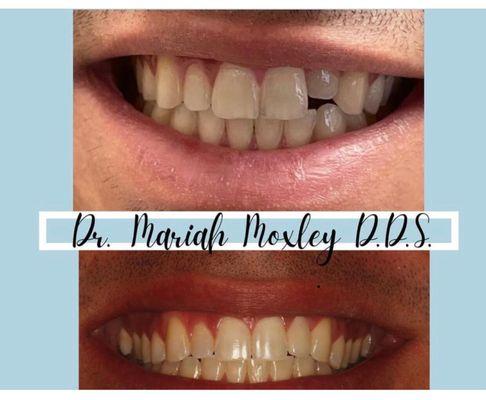 Moxley Family Dental