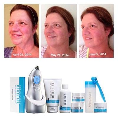Redefine Regimen