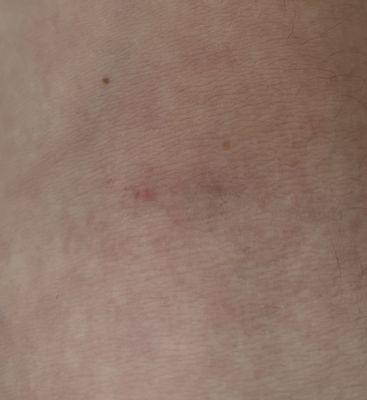 Alex Lau Acupuncture