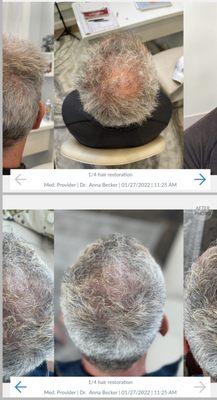 Aveil Medical Spa