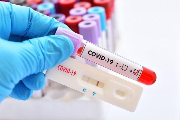 COVID Testing Center