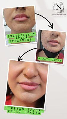 Noble Art Aesthetics