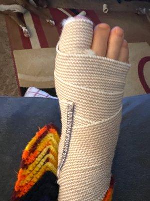 1 surgery 20 mins at McBride.