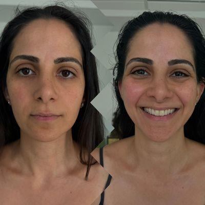 Before/After Royal 60min