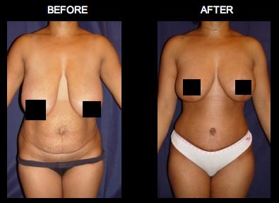 Lexington Plastic Surgeons