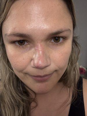 Dawes Fretzin Dermatology Group