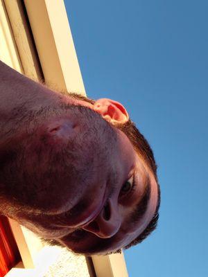 Mark Glyman MD, DDS, FACS