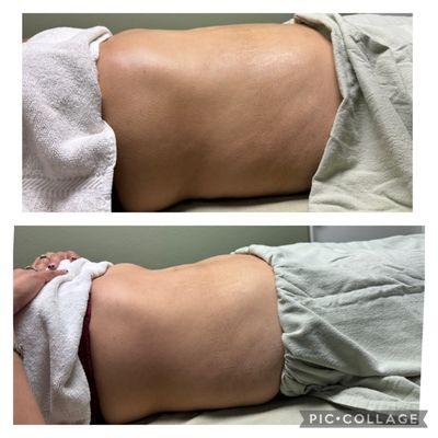 IPSB College Massage Therapy Clinic